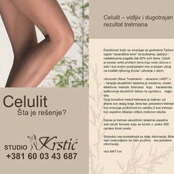 Tretman uklanjanje celulita Čačak
