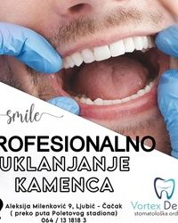 Uklanjanje zubnog kamenca Cacak