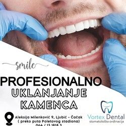 Uklanjanje zubnog kamenca Cacak