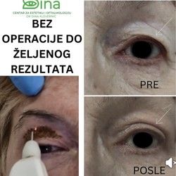 𝗥𝗘Š𝗜𝗧𝗘 𝗦𝗘 𝗩𝗜Š𝗞𝗔 𝗞𝗢Ž𝗘 𝗜𝗭𝗡𝗔𝗗 𝗢Č𝗜𝗝𝗨 𝗕𝗘𝗭 𝗢𝗣𝗘𝗥𝗔𝗖𝗜𝗝𝗘