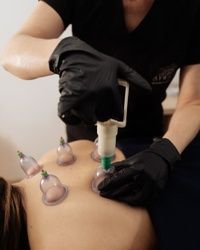 Cupping terapija vakumom