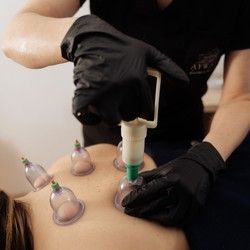 Cupping terapija vakumom