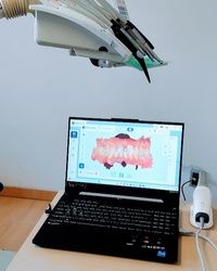 3D sken zuba – prvi korak ka savršenom osmehu | Digitalni dizajn osmeha BELLE DENT, Novi Beograd, Blok 63