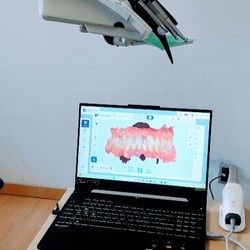 3D sken zuba – prvi korak ka savršenom osmehu | Digitalni dizajn osmeha BELLE DENT, Novi Beograd, Blok 63