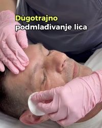 Dugotrajno podmlađivanje lica