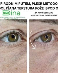 Rešavanje kesica ispod oka