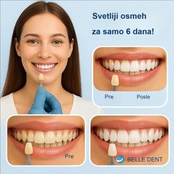 izbelite zube za samo 6 dana!