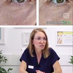 Korekcija regije oko oka