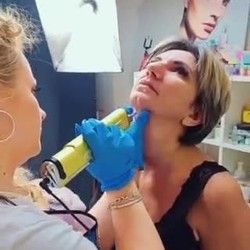 lipoliza Vrata