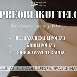 Shock wave terapija tela