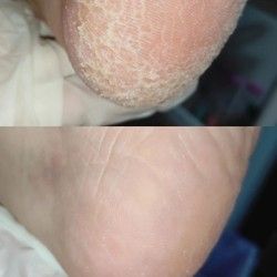 pedikir Divine beauty house Kragujevac 