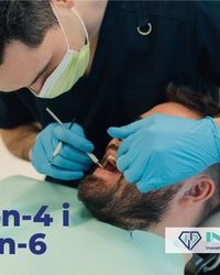 All-on-4 i All-on-6 – trajno rešenje za bezube i delimično bezube pacijente. | In Dental Novi Sad