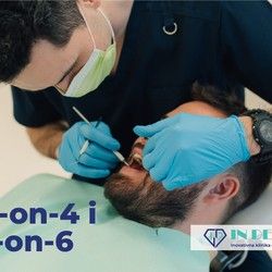All-on-4 i All-on-6 – trajno rešenje za bezube i delimično bezube pacijente. | In Dental Novi Sad