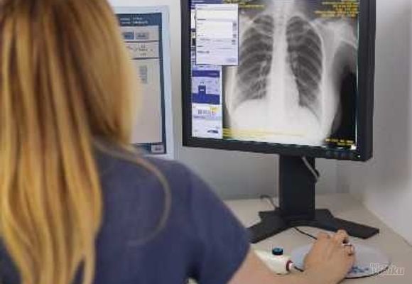 rtg-snimanje-pluca-novi-sad-brza-i-precizna-dijagnostika-0013d8.jpg