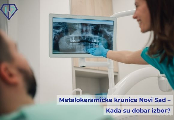metalokeramicke-krunice-novi-sad-kada-su-dobar-izbor-9ba57c.jpg
