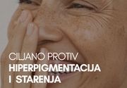 Laserski tretmani za hiperpigmentacije (fleke) Vračar