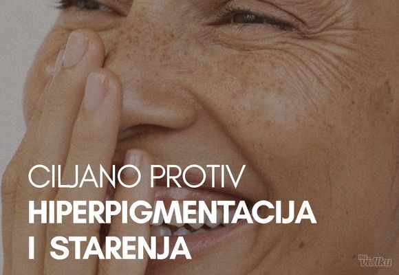 laserski-tretmani-za-hiperpigmentacije-fleke-vracar-6155a4.jpg
