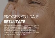 Laserski tretmani za hiperpigmentacije (fleke) Vračar