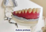 Zubne proteze | In Dental Novi Sad
