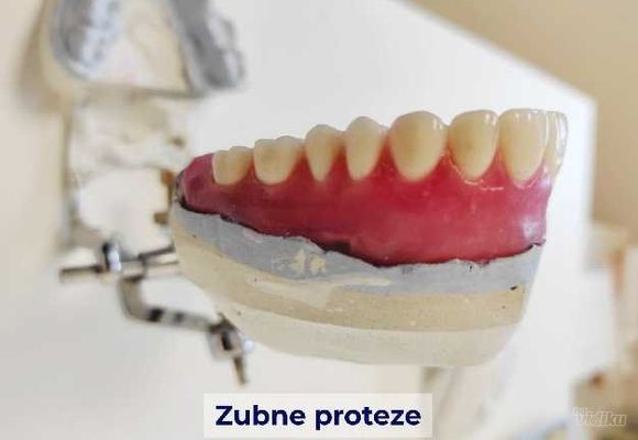 zubne-proteze-or-in-dental-novi-sad-b3ba19.jpg