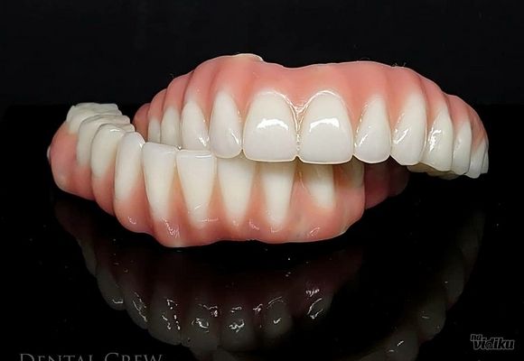 Bazalni zubni implanti - Dental Crew Zubotehnička laboratorija