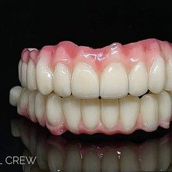 Bazalni zubni implanti - Dental Crew laboratorija