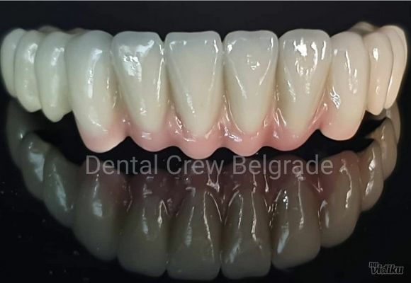Bazalni zubni implanti - Dental Crew Zubotehnička laboratorija