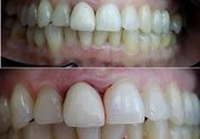 Ortodonstka terapija