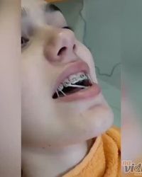 Ortodonstki tretman