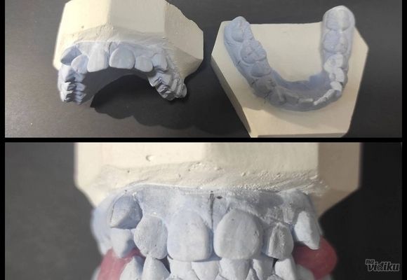 Prvi ortodonstki pregled