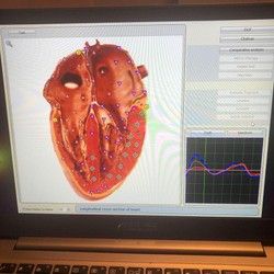 Biorezonantni snimak srca, kvantna medicina