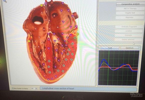 Biorezonantni snimak srca, kvantna medicina