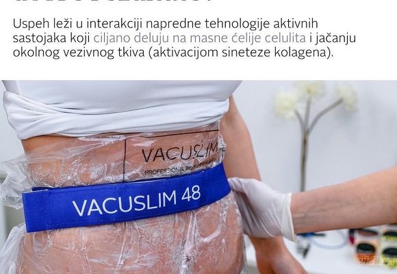Vacumslim tretman Novi Sad