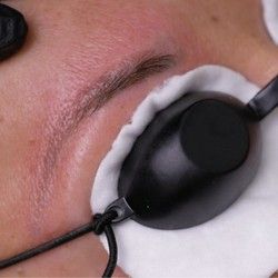 Lasersko uklanjanje trajne šminke 