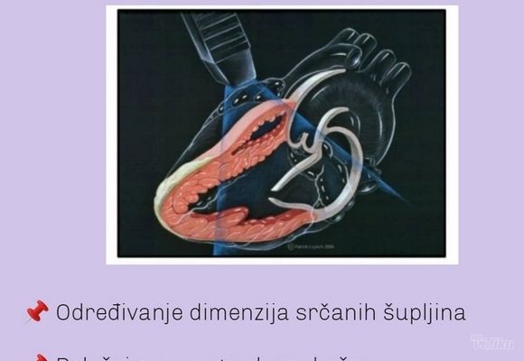 Ultrazvuk srca