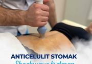 Anticelulit tretman Shockwave