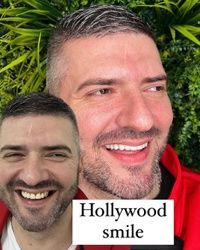Hollywood smile Beograd