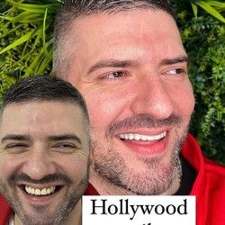 Hollywood smile Beograd