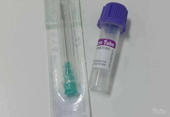 test-na-srcanog-crva-zarkovo-496c5d.jpg