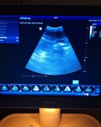 Ultrazvuk pasa Zarkovo