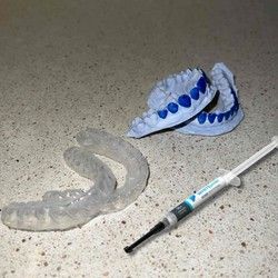 Kućno izbeljivanje zuba
