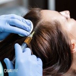 Tretmanom mezoterapije za bujnu kosu kao sa reklame