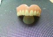 Totalna zubna proteza
