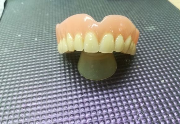 totalna-zubna-proteza-8adde7-1.jpg
