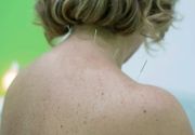 Bolovi u vratu - lecenje