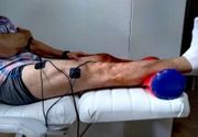 Elektrostimulacija quadricepsa nakon operacije prednjih ukrštenih ligamenata. 