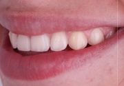 Risus Ortodoncija - Put do savrsenog osmeha