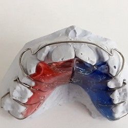 Mobilna zubna proteza Banovo brdo