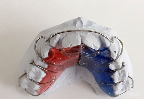 mobilna-zubna-proteza-banovo-brdo-b28f77.jpg