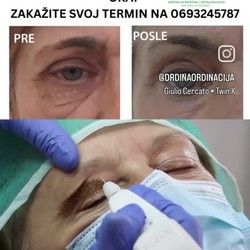 𝗥𝗘𝗦𝗜𝗧𝗘 𝗦𝗘 𝗩𝗜𝗦𝗞𝗔 𝗞𝗢𝗭𝗘 𝗢𝗞𝗢 𝗢𝗞𝗔 𝗕𝗘𝗭 𝗢𝗣𝗘𝗥𝗔𝗖𝗜𝗝𝗘